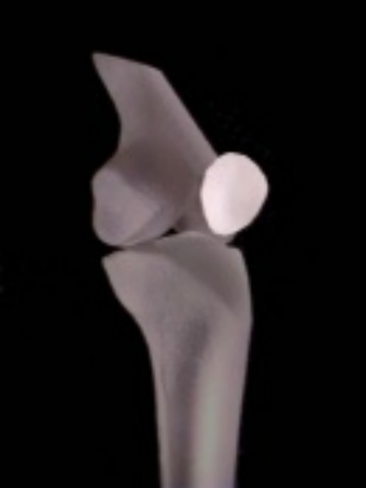 Cristalrotule.JPG (22632 octets)